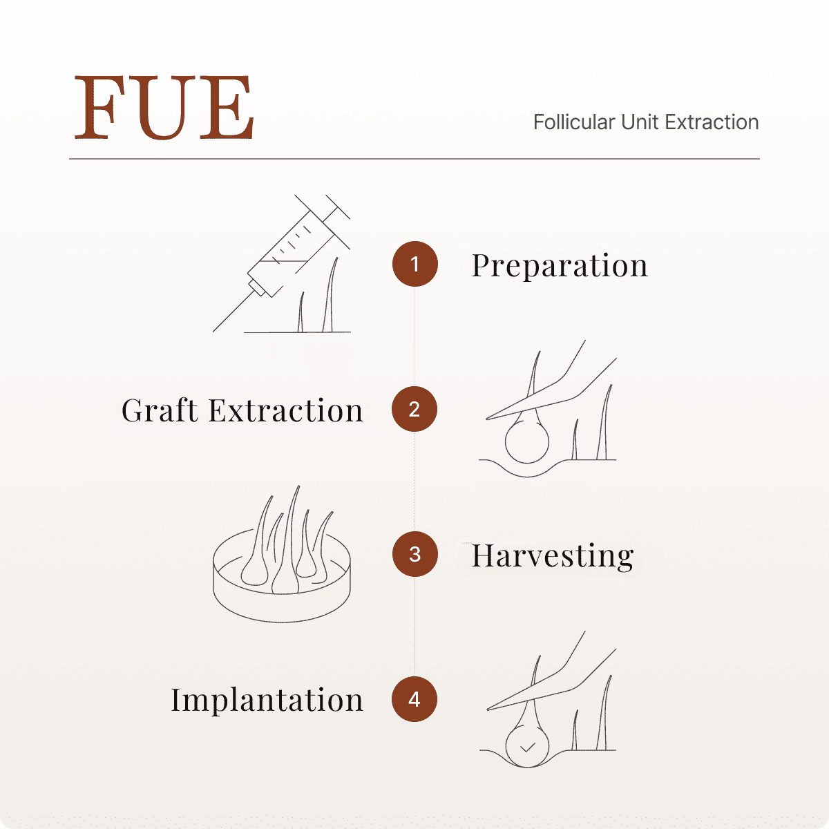 FUE technique infographic showing the 4-step process: preparation, graft extraction, harvesting, and implantation