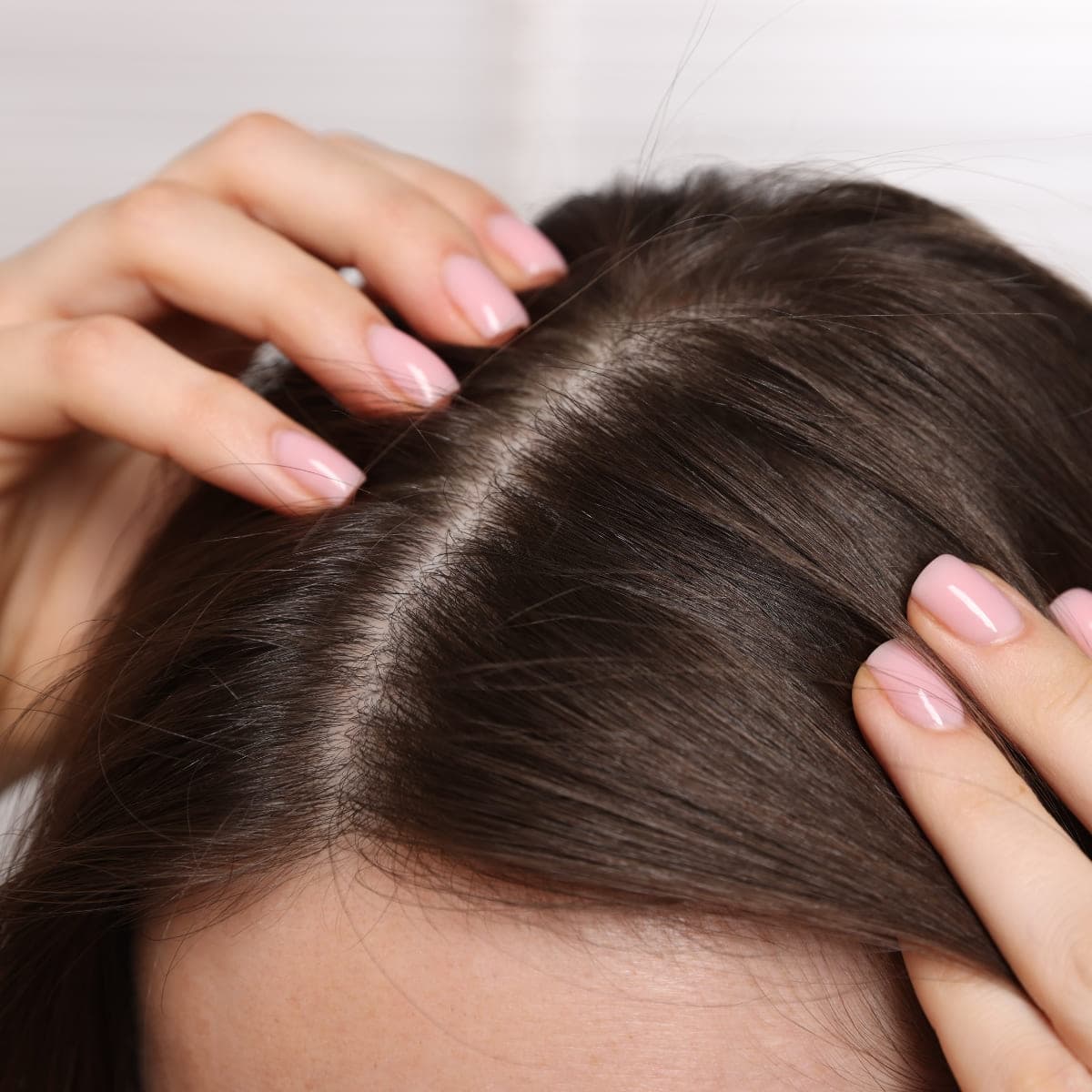 Close-up of natural-looking female hair transplant result