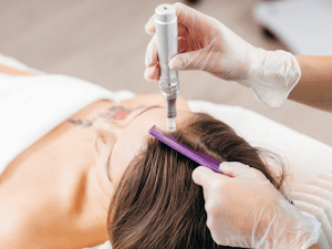 Women's Hair Restoration