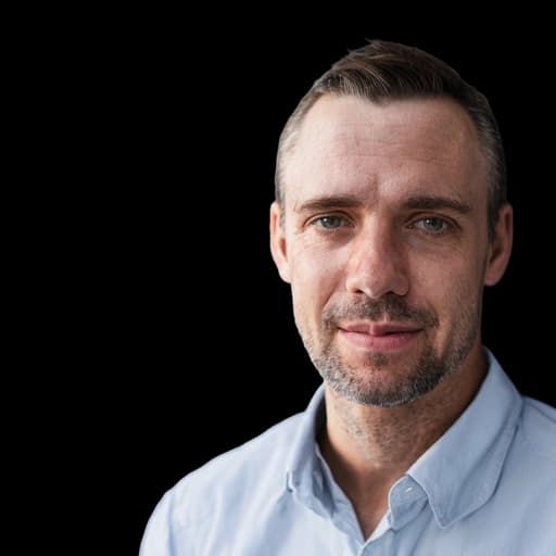 After AI hairline simulation — restored hairline preview