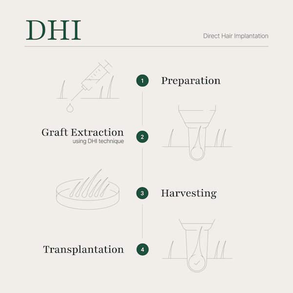 Illustration of the DHI Choi Implanter Pen