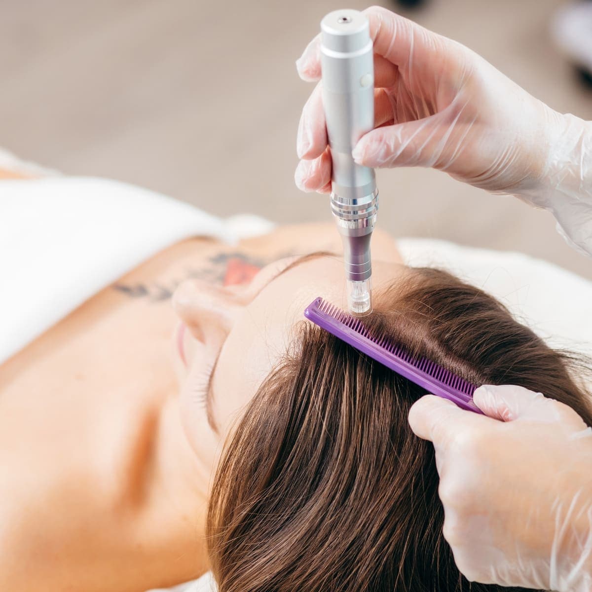 Female pattern hair loss illustration showing Ludwig Scale stages