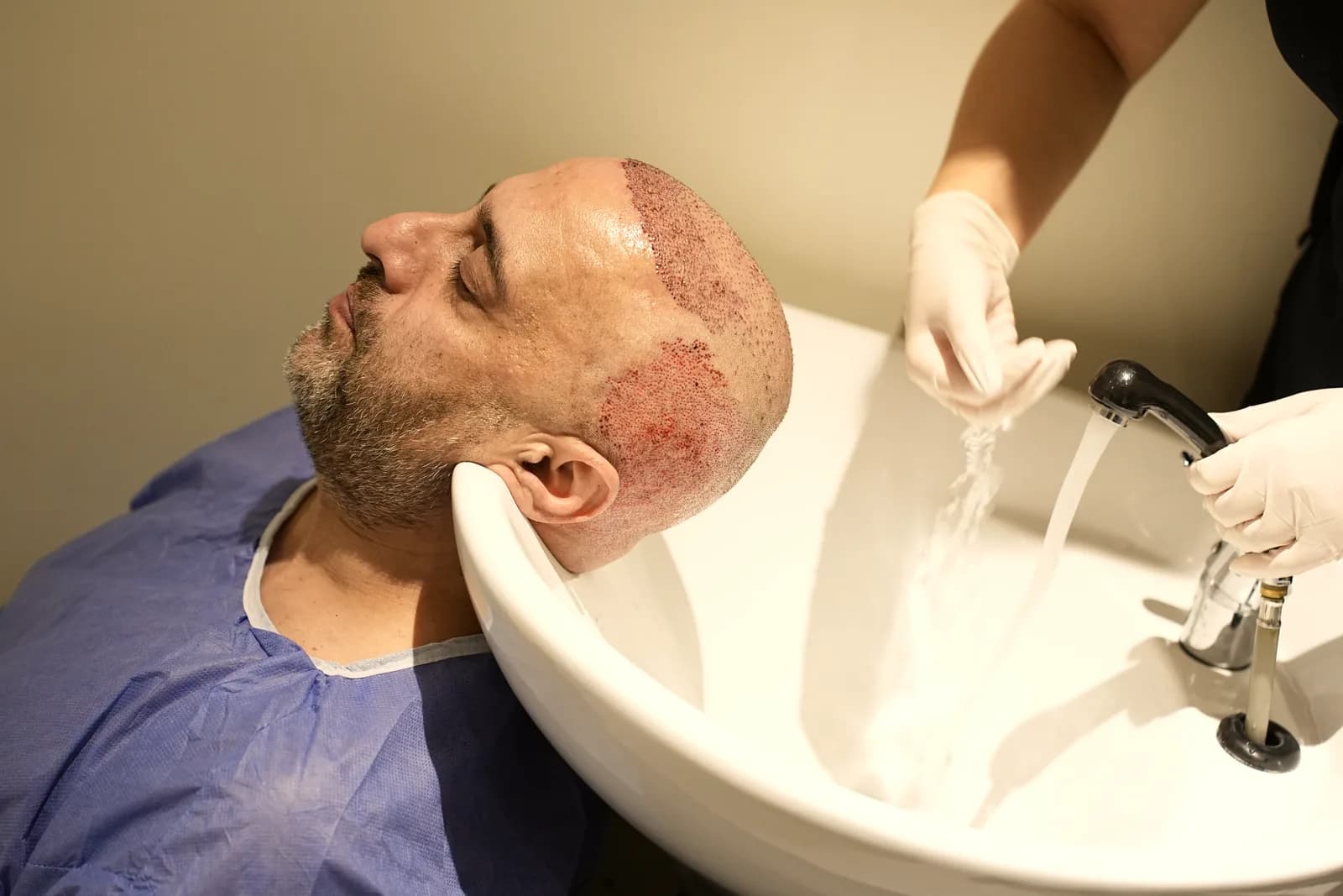 Post-procedure aftercare at an Electivio partner clinic in Turkey