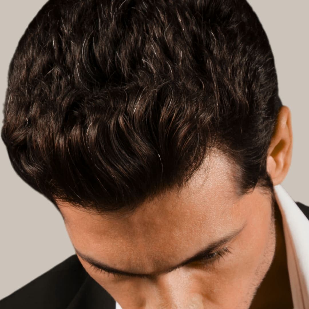 FUT Hair Transplant illustration